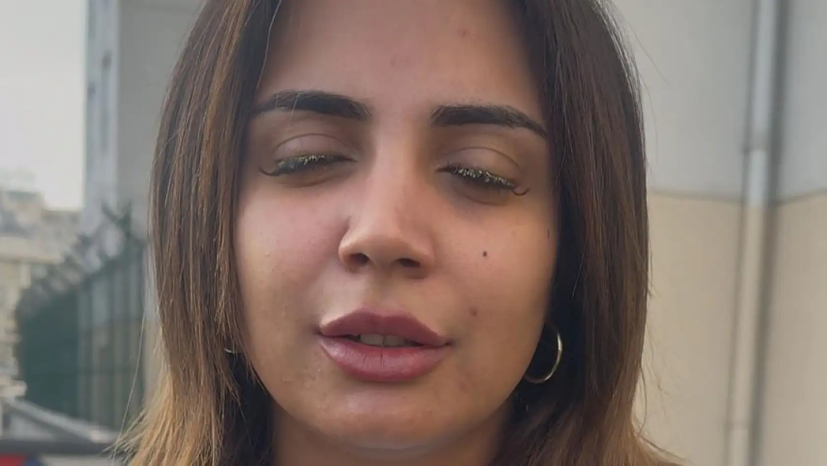 Güzellik merkezinde genç kadının gözüne yapıştırıcı kaçtı: 'Kör olabilirdim'