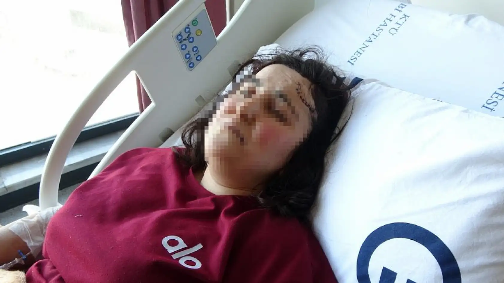 Boşanma aşamasındaki kocasından bıçaklı saldırıya uğrayan kadın tedavi altında