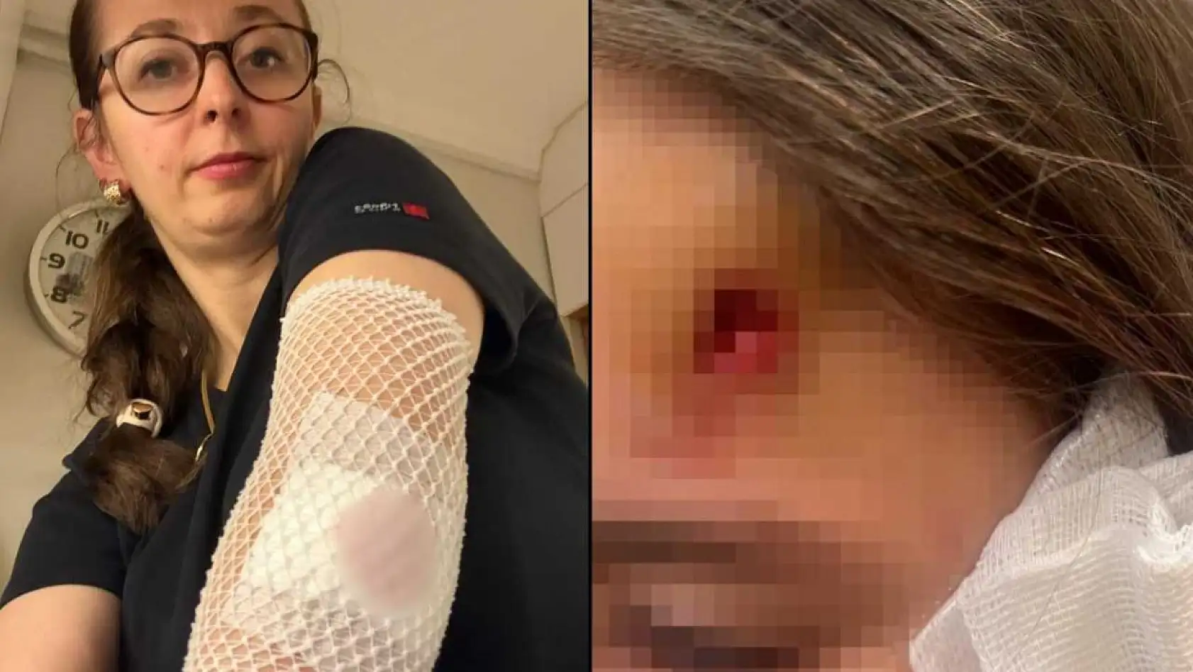 Okul çıkışında dehşeti yaşadılar: Ters yönden gelen scooter, kadına ve çocuğa çarptı