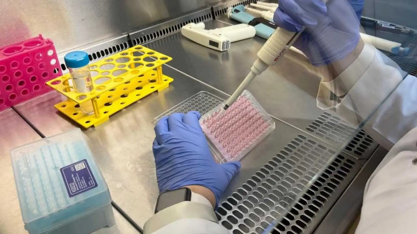 Parkinson'da bağırsak- beyin iletişimi çip üstü organ teknolojisiyle araştırılıyor