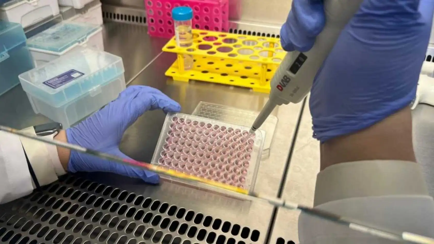 Parkinson'da bağırsak- beyin iletişimi çip üstü organ teknolojisiyle araştırılıyor