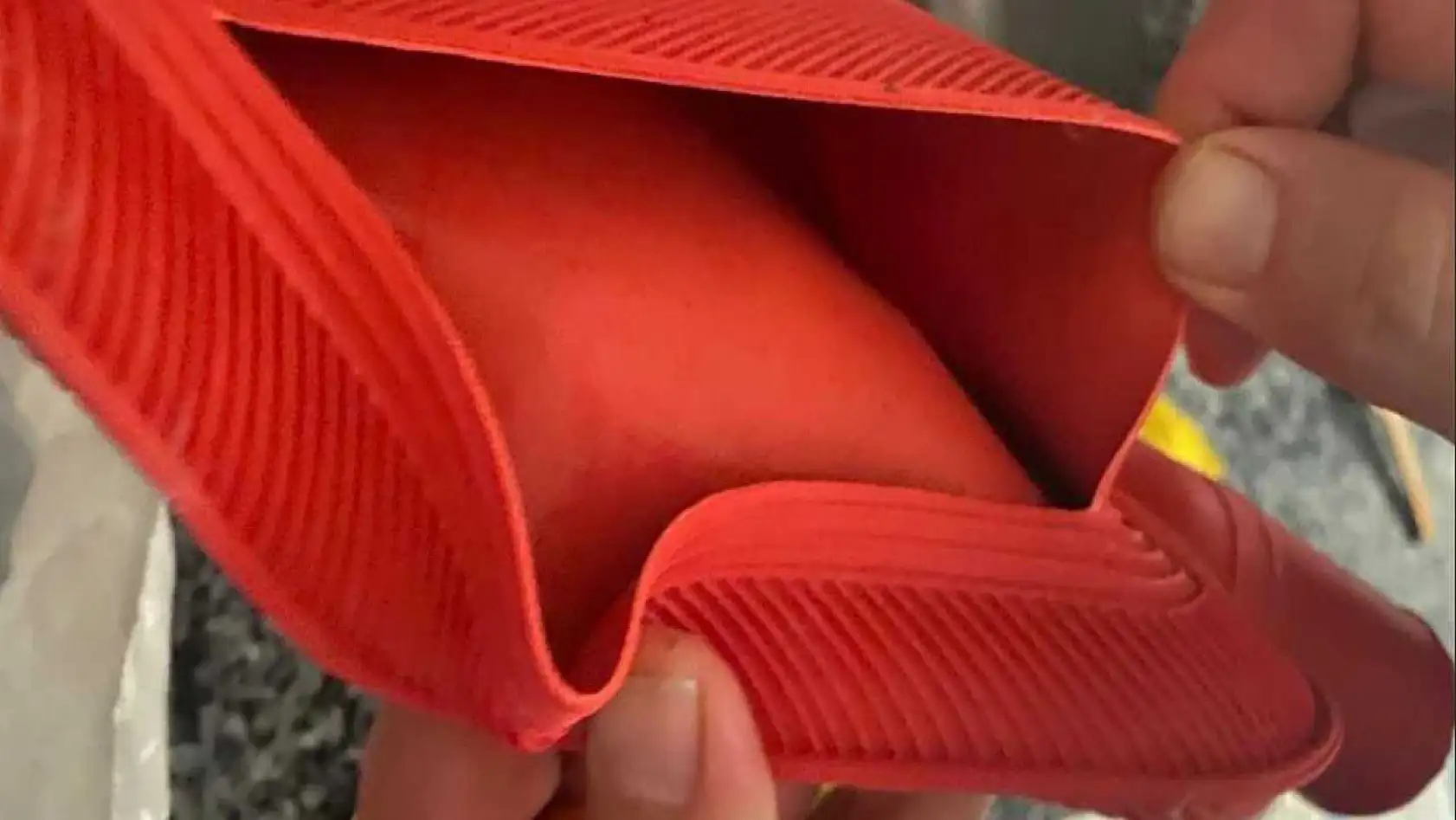 Sıcak su torbası patladı, genç kızın vücudunun yüzde 25'i yandı: 'O acının tarifi yok'