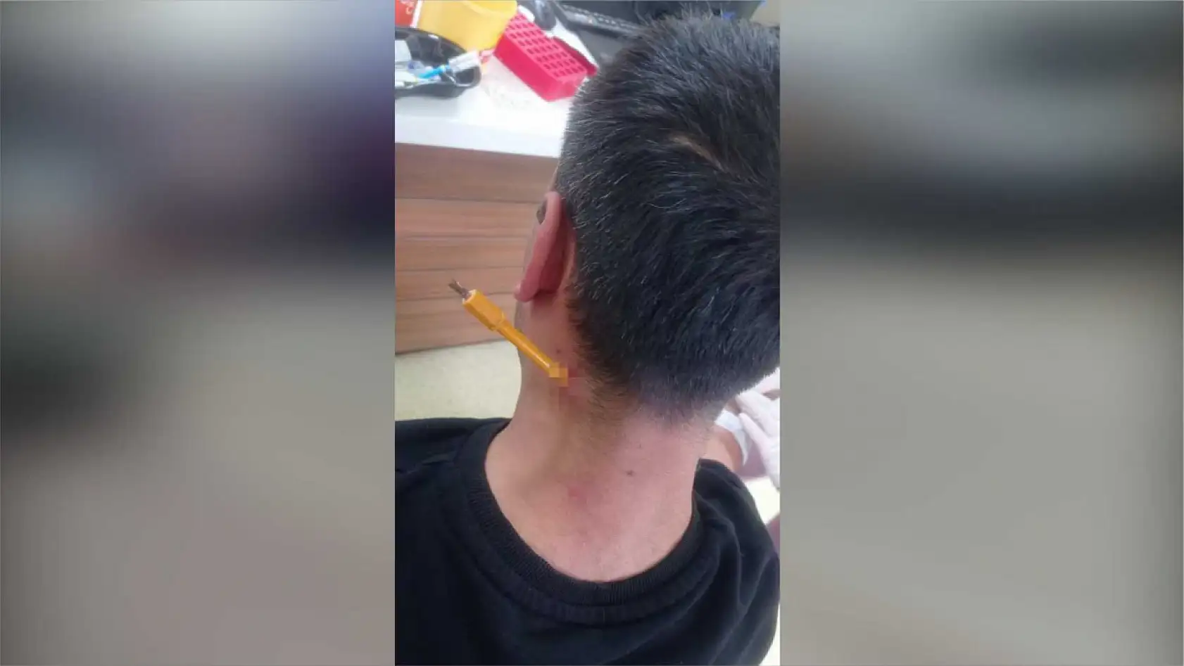 Park yeri kavgası esnasında boynuna tornavida saplandı