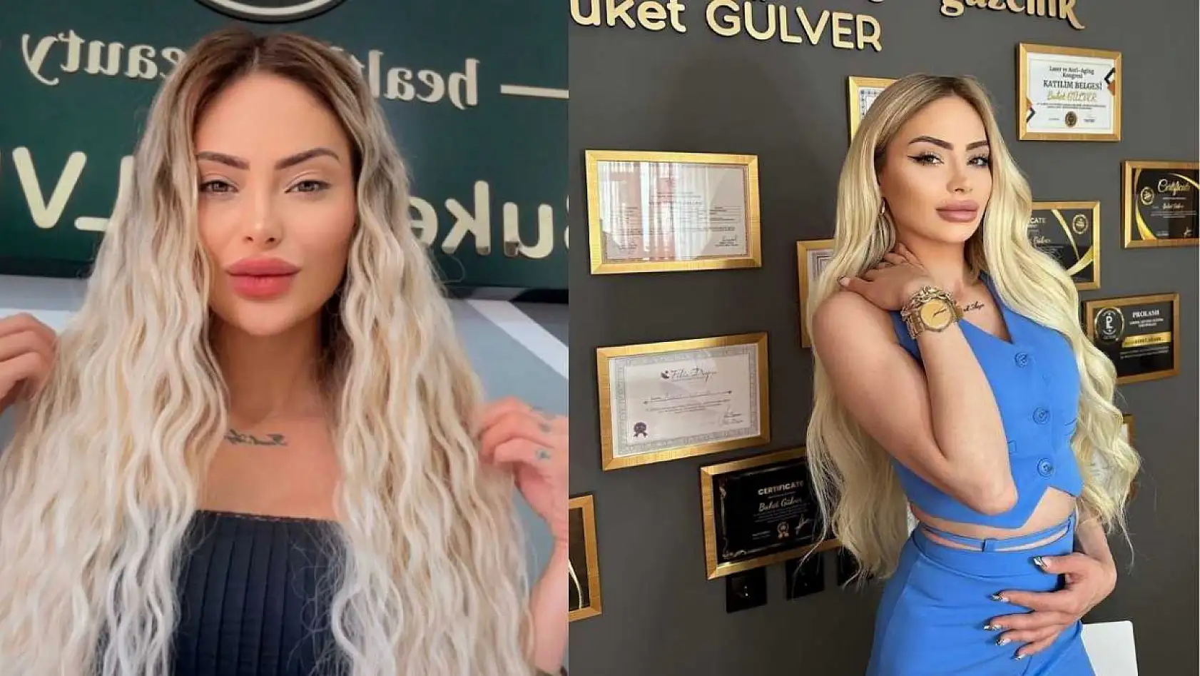 Genç estetisyenin ölüm sebebini ablası duyurdu