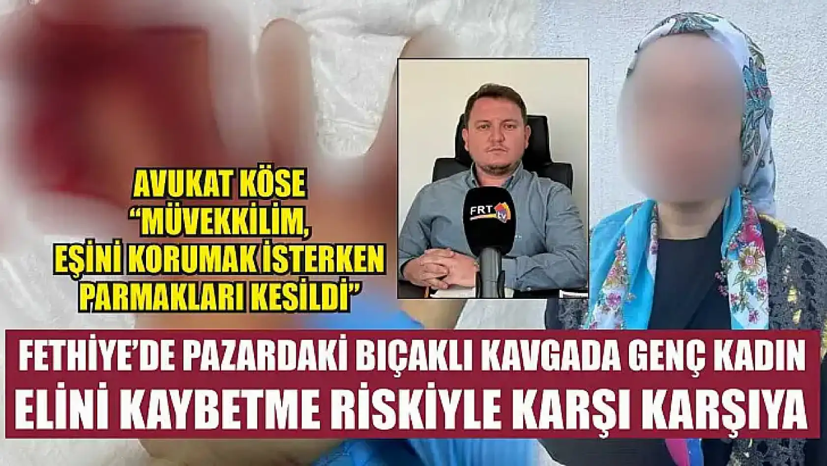 Fethiye'de Pazardaki Bıçaklı Kavgada Genç Kadın Elini Kaybetme Riskiyle Karşı Karşıya