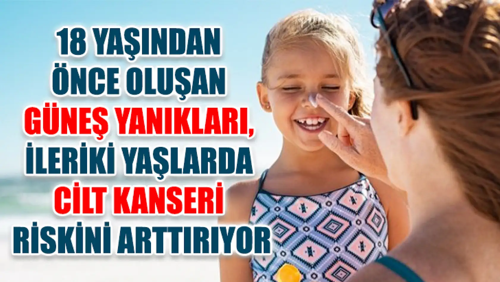 18 Yaşından Önce Oluşan Güneş Yanıkları, İleriki Yaşlarda Cilt Kanseri Riskini Arttırıyor