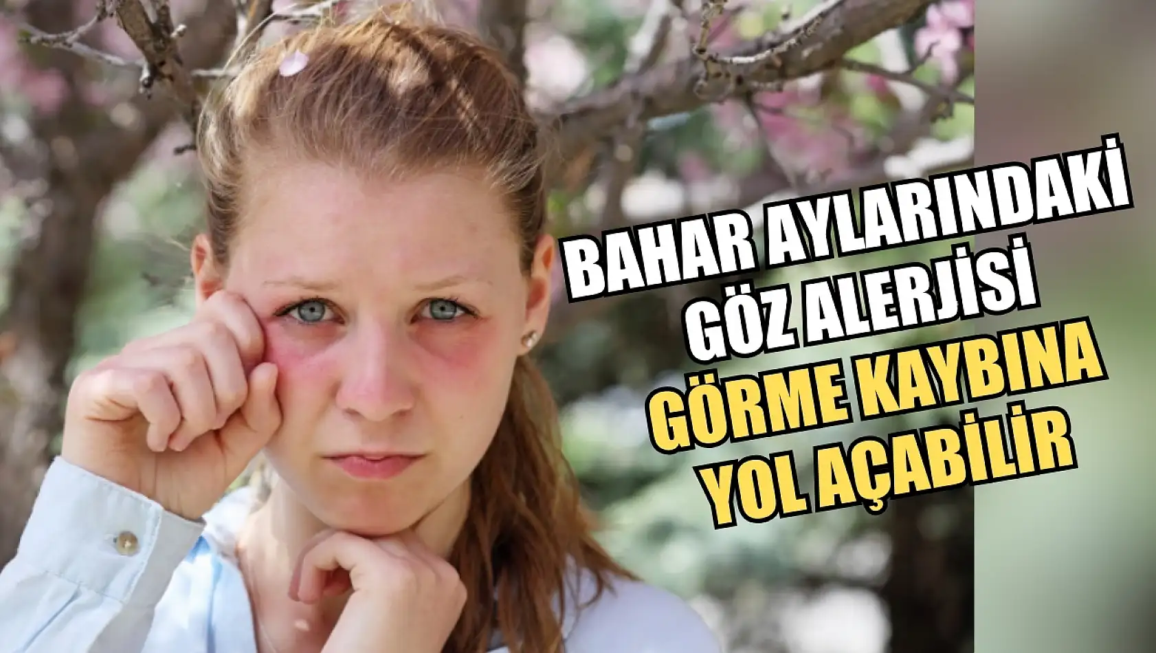 Bahar aylarındaki göz alerjisi görme kaybına yol açabilir