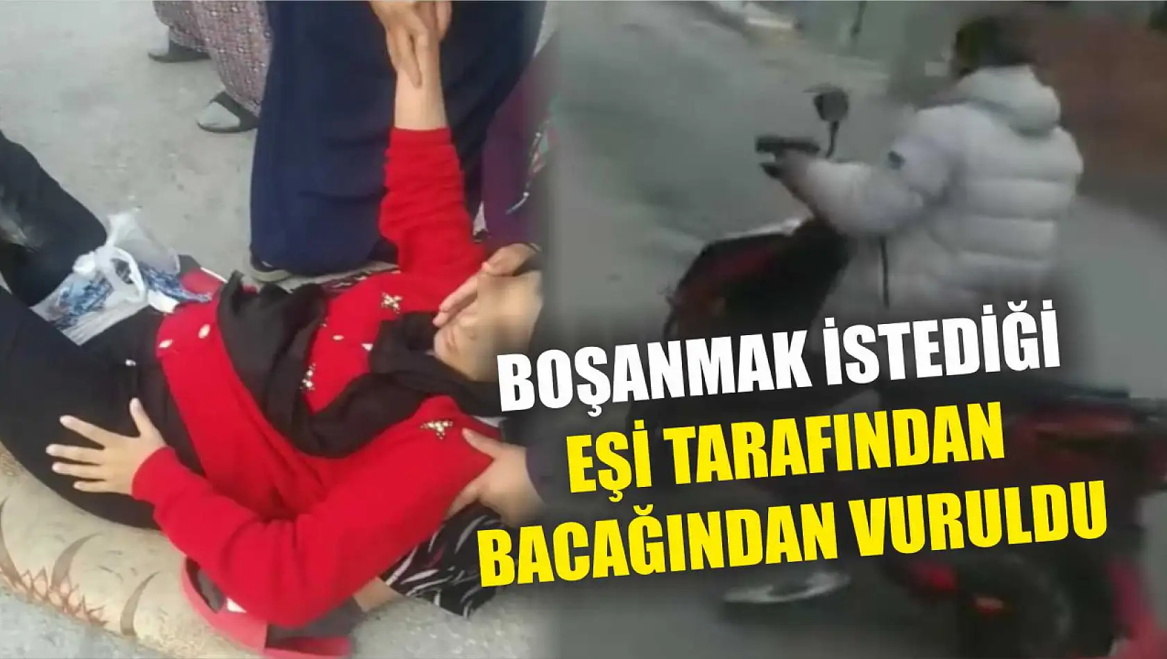 Boşanmak istediği eşi tarafından bacağından vuruldu