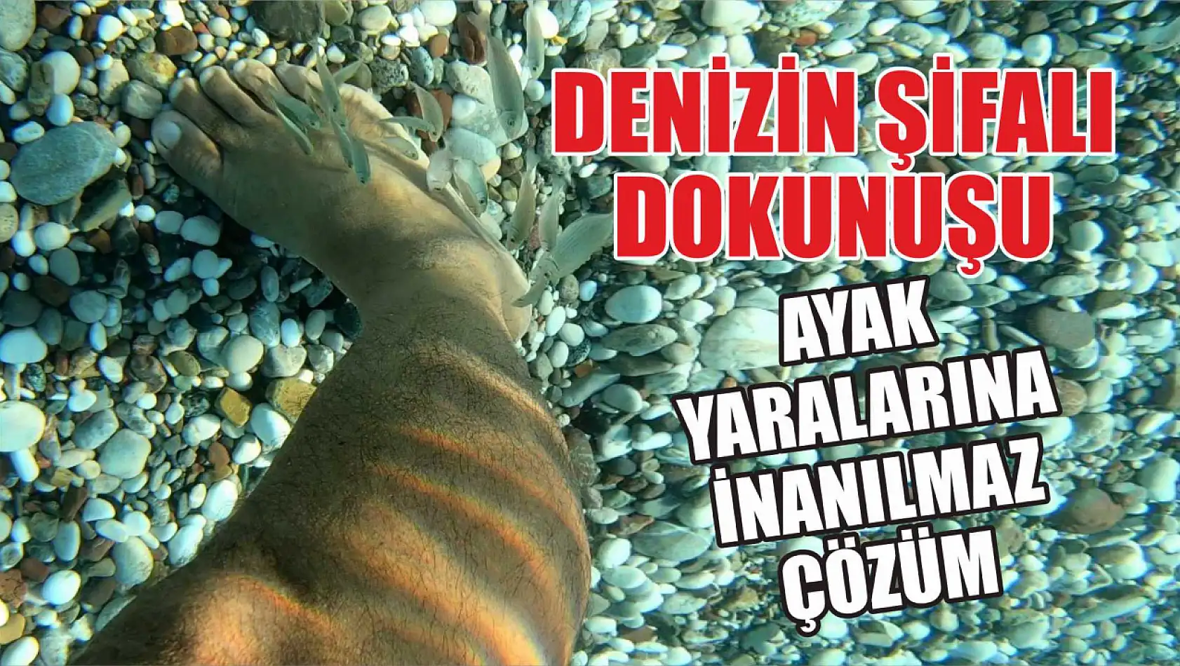 Denizin Şifalı Dokunuşu: Ayak Yaralarına İnanılmaz Çözüm