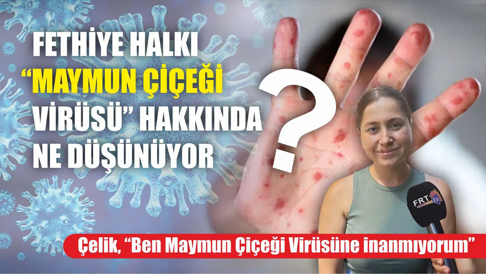 Fethiye halkı 'Maymun Çiçeği Virüsü' hakkında ne düşünüyor?