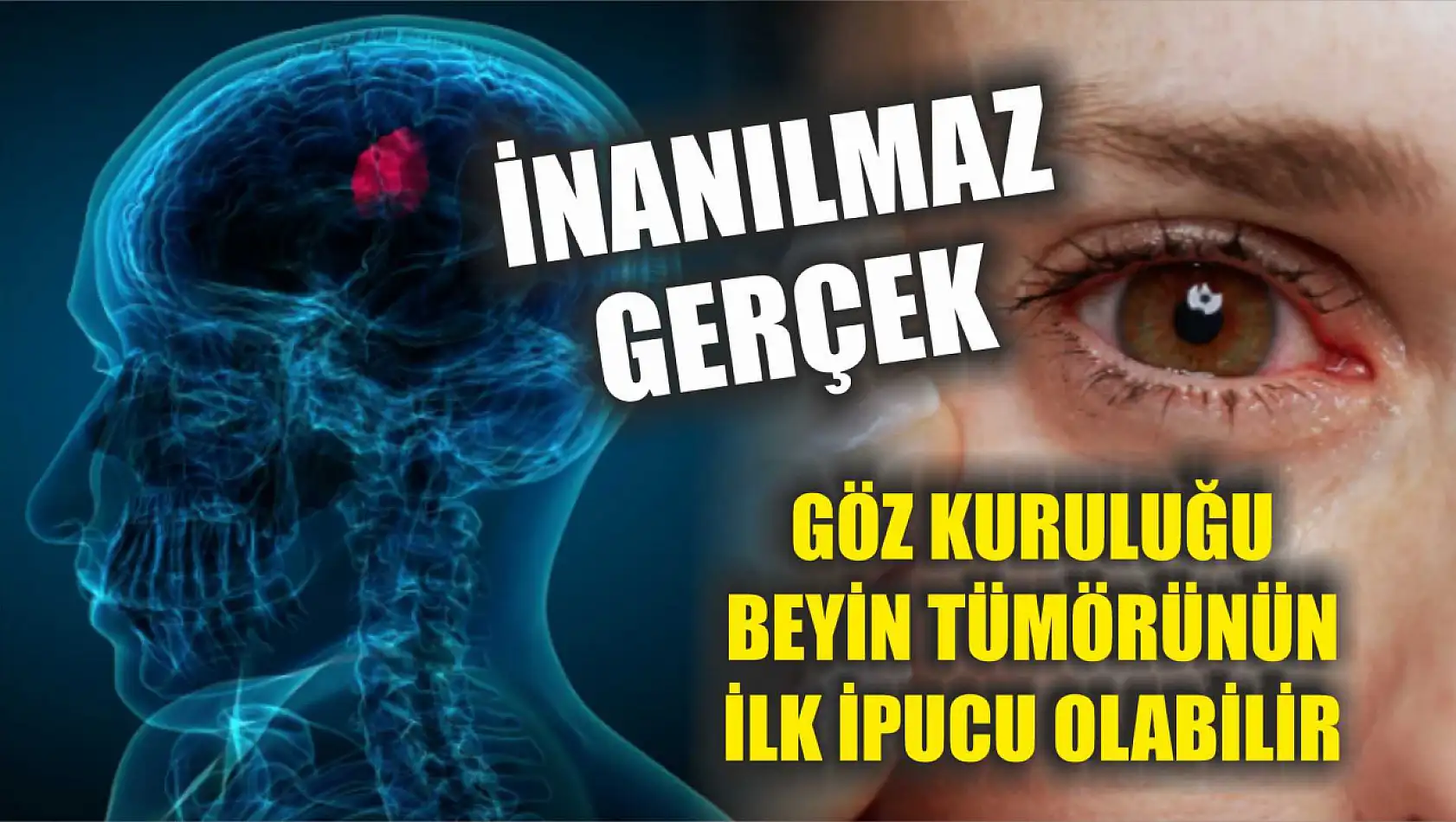 İnanılmaz gerçek: Göz kuruluğu beyin tümörünün ilk ipucu olabilir