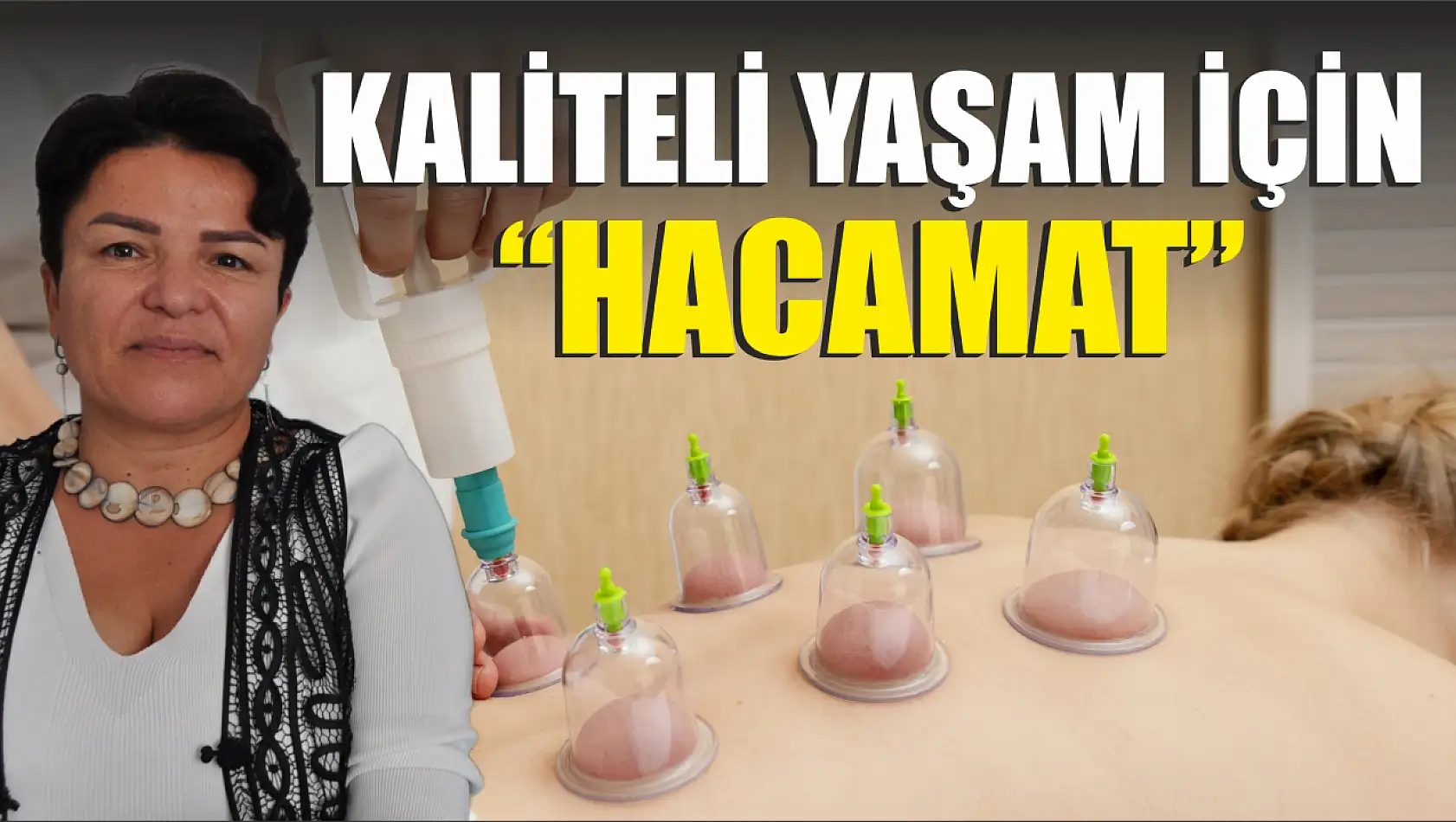 Kaliteli yaşam için 'Hacamat'