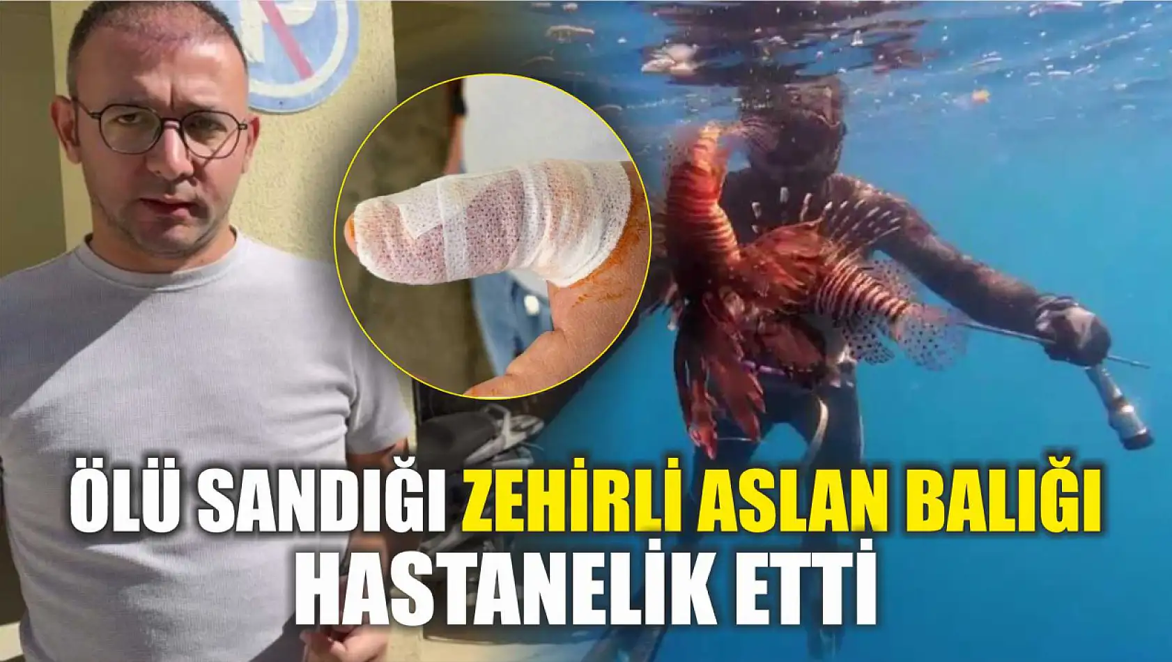 Ölü sandığı zehirli aslan balığı hastanelik etti