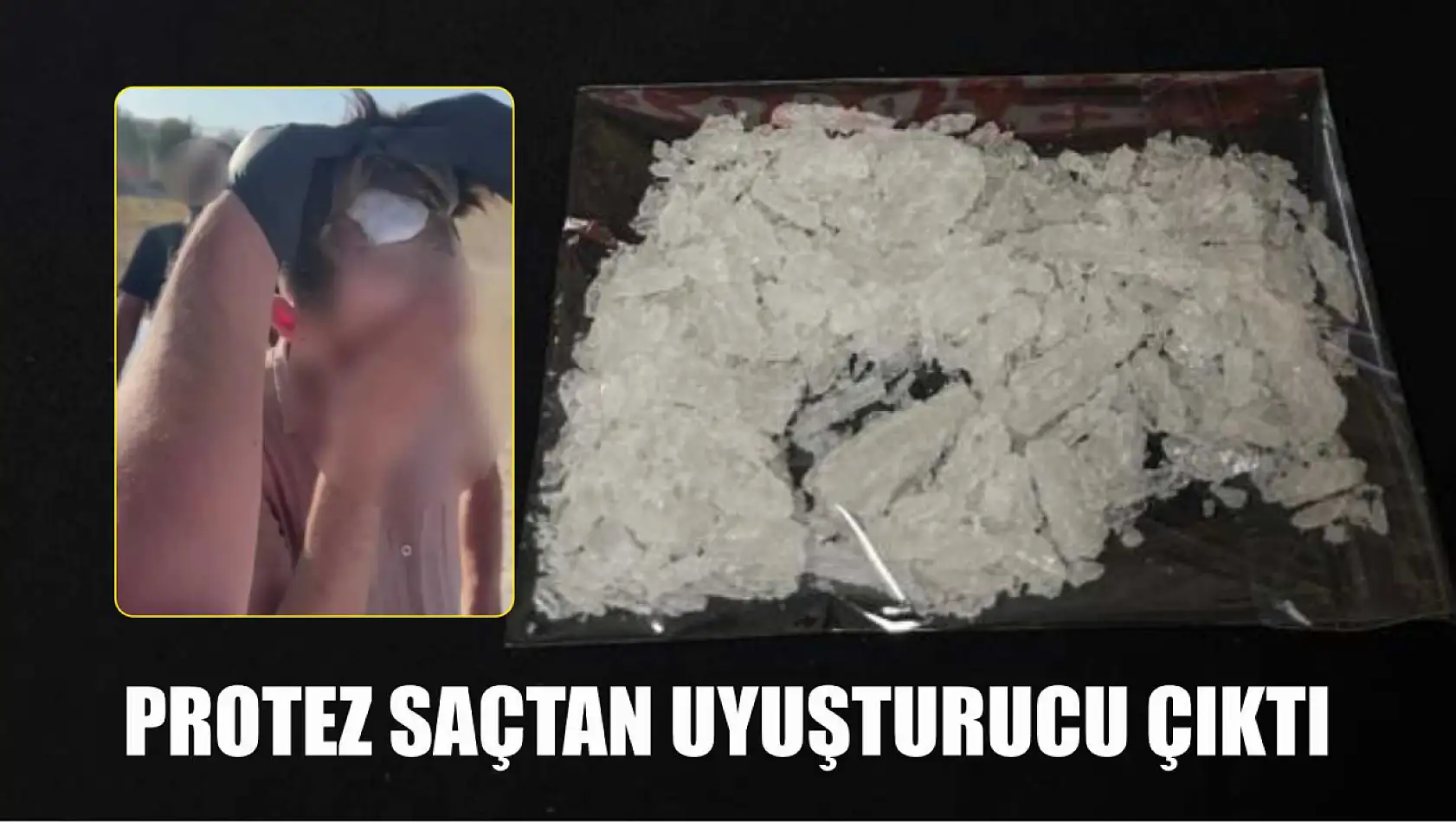 Protez saçtan uyuşturucu çıktı