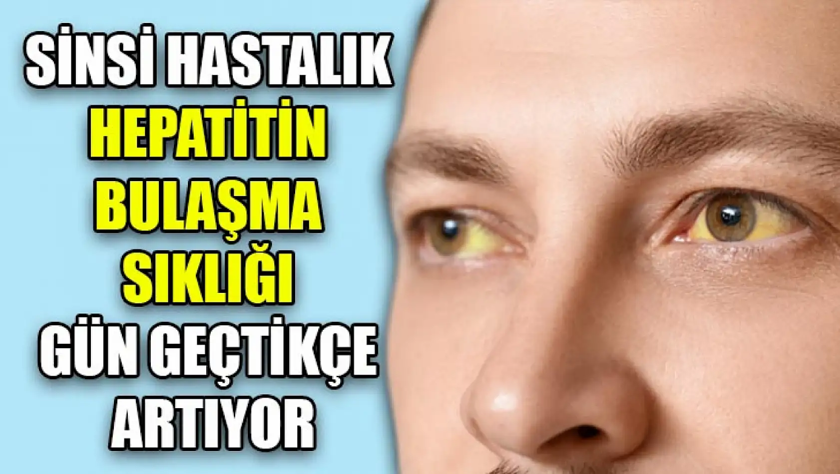 Sinsi Hastalık Hepatitin Bulaşma Sıklığı Gün Geçtikçe Artıyor