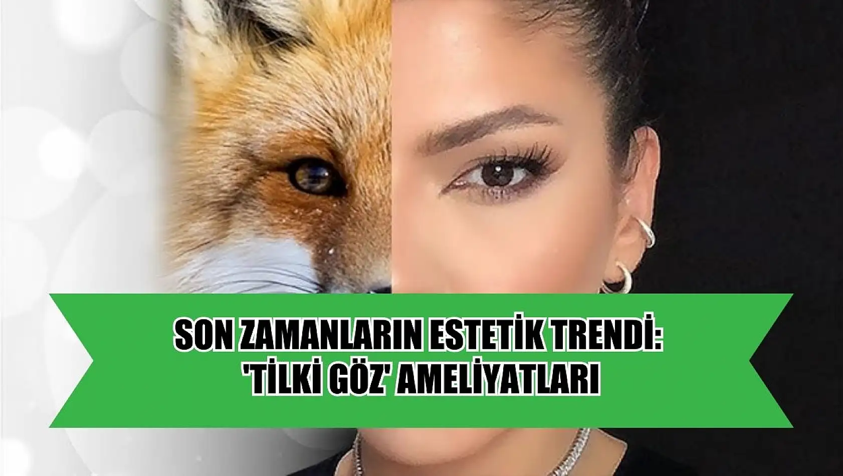 Son zamanların estetik trendi: 'Tilki göz' ameliyatları