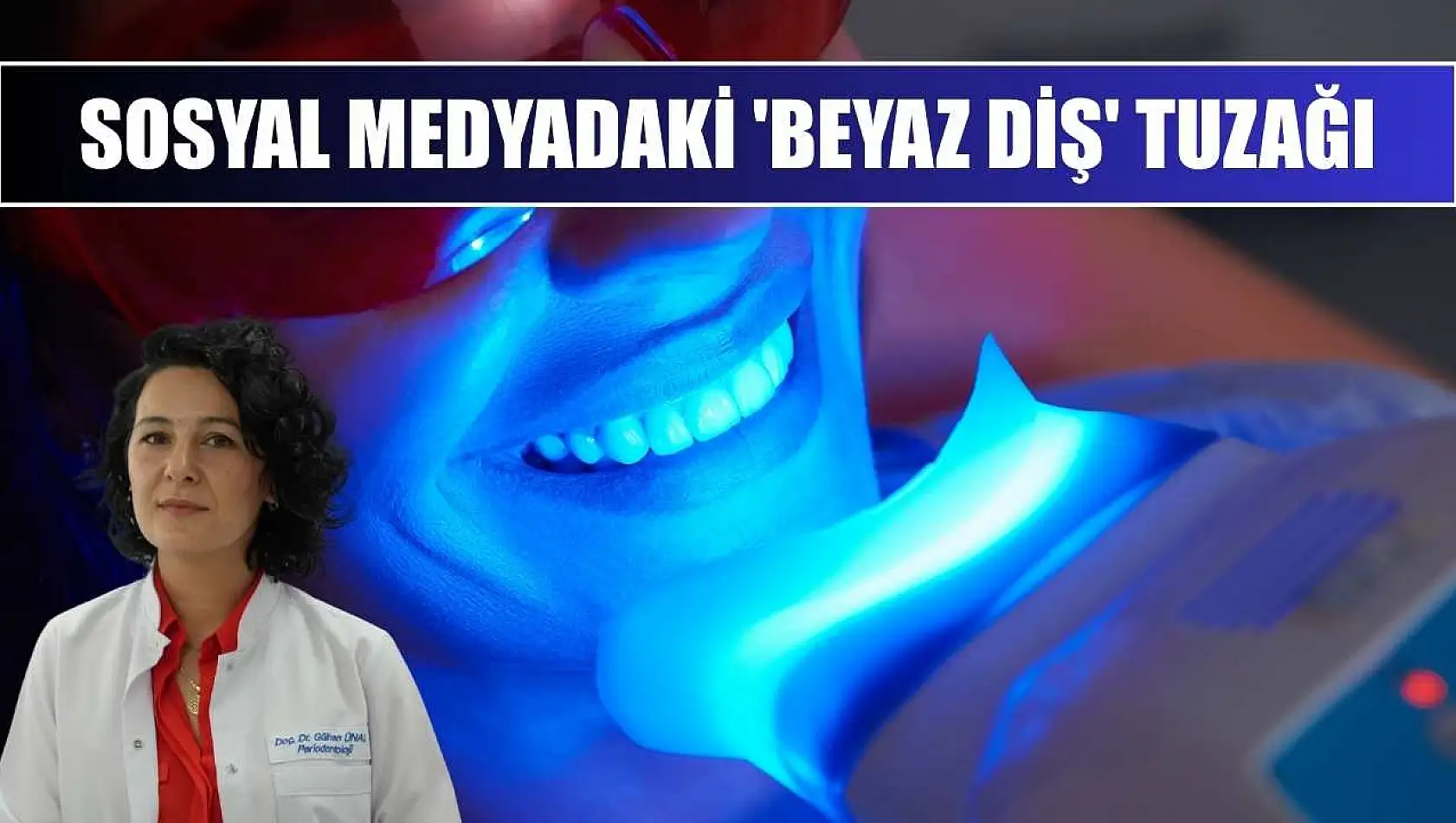 Sosyal medyadaki 'beyaz diş' tuzağı