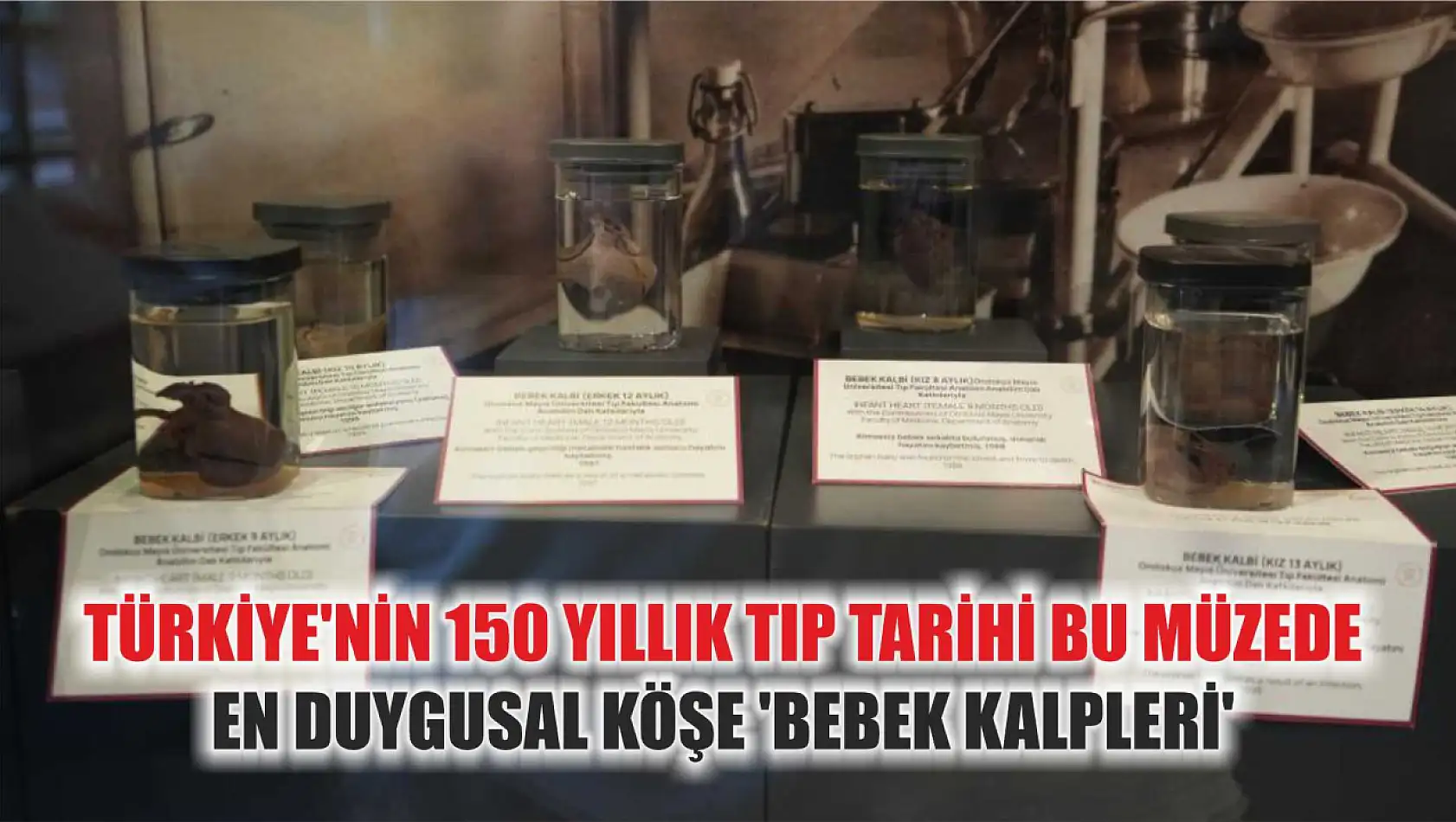 Türkiye'nin 150 yıllık tıp tarihi bu müzede: En duygusal köşe 'bebek kalpleri'