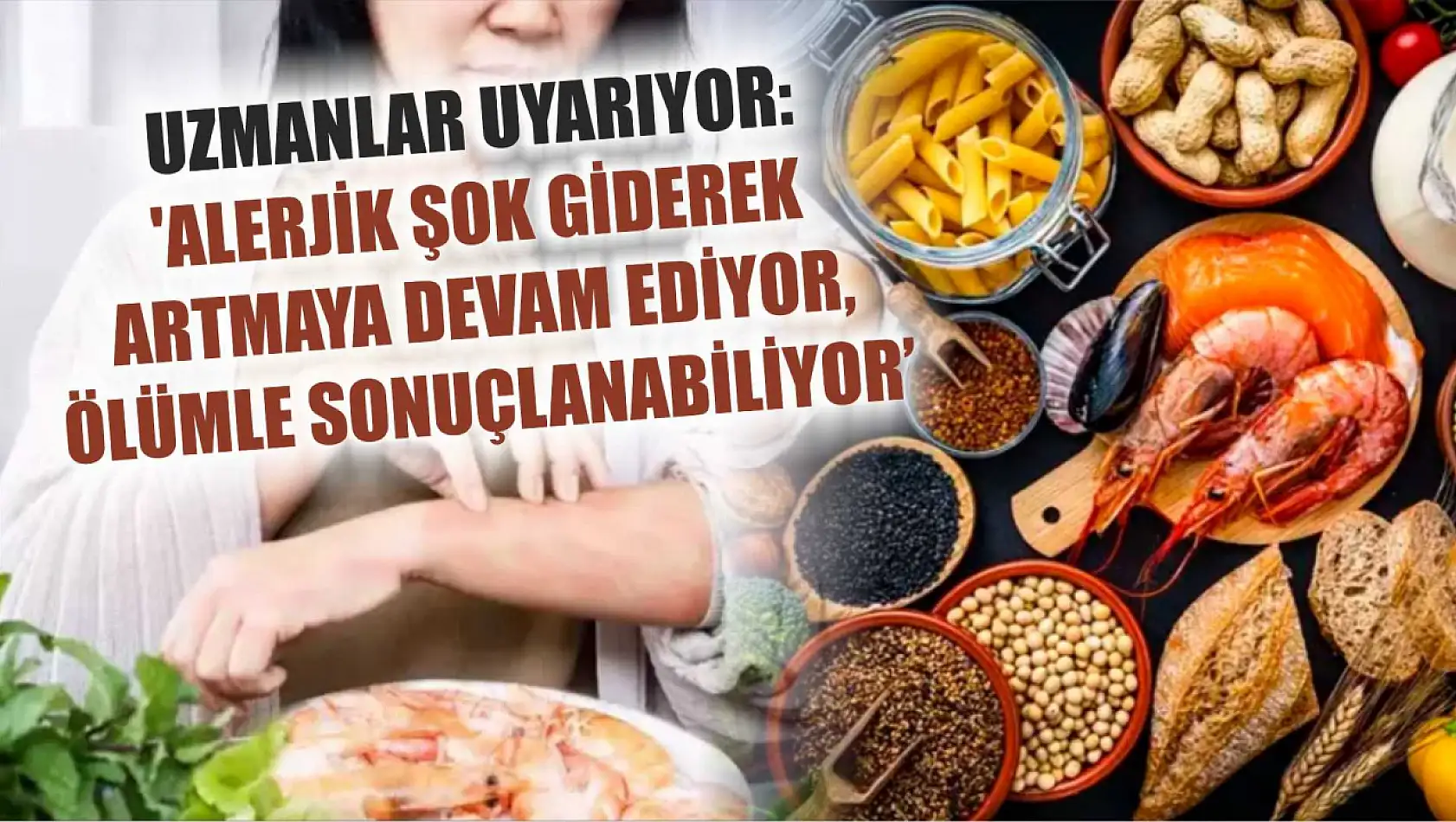 Uzmanlar uyarıyor: 'Alerjik şok giderek artmaya devam ediyor, ölümle sonuçlanabiliyor'