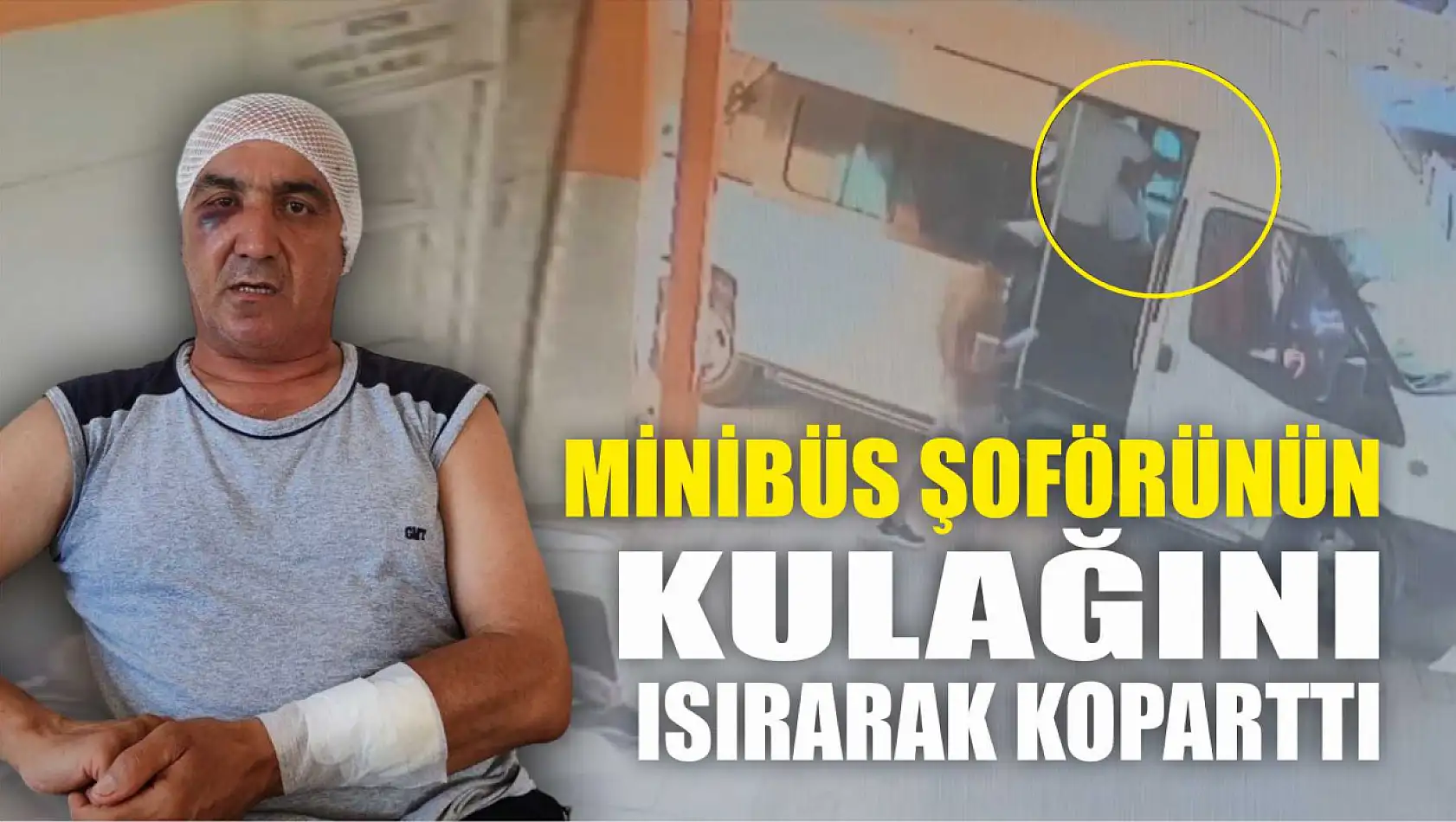 Yolcu, minibüs şoförünün kulağını ısırarak koparttı