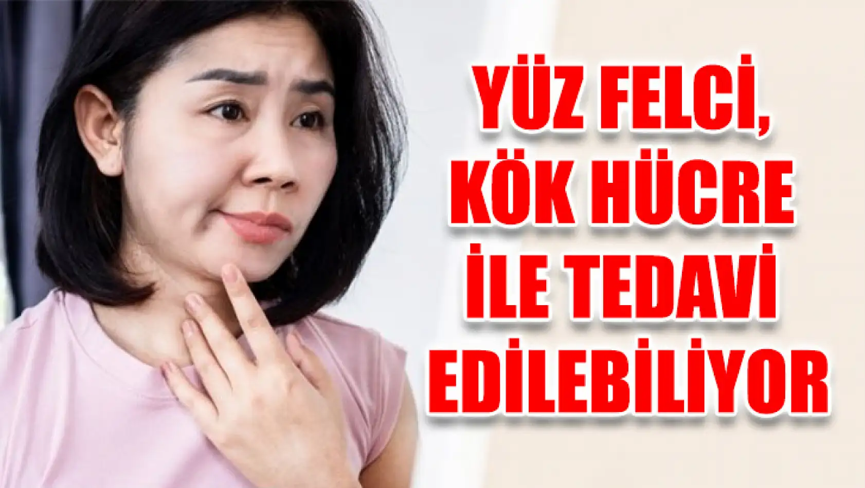 Yüz Felci, Kök Hücre İle Tedavi Edilebiliyor