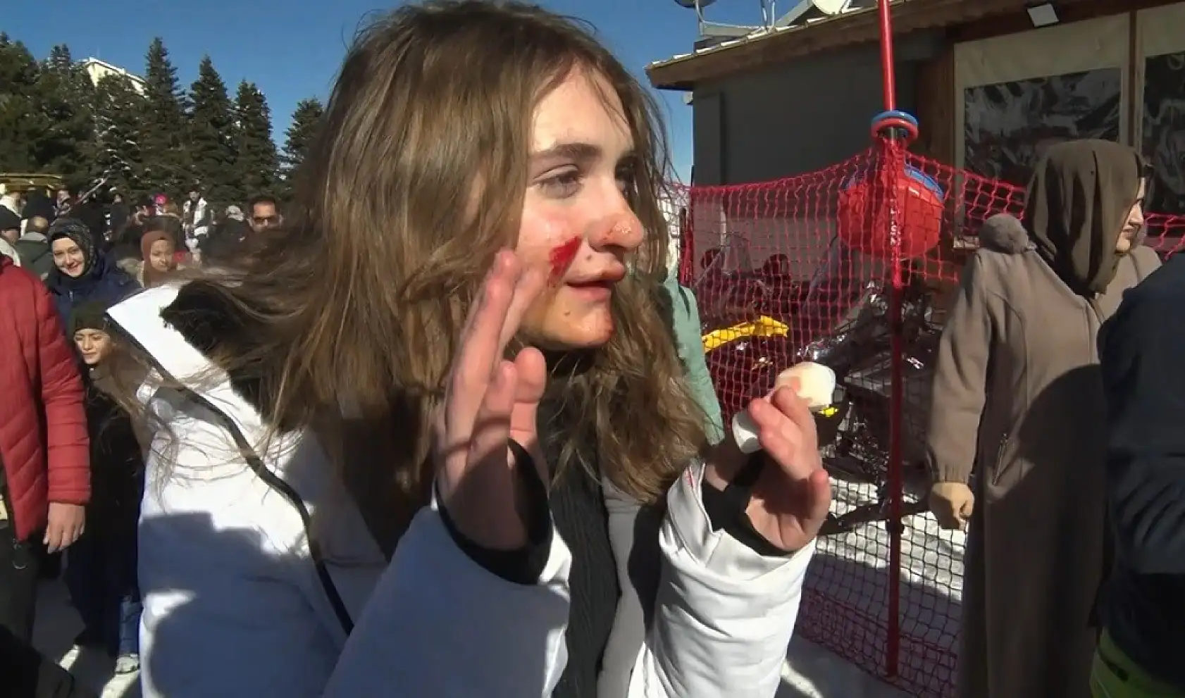 Uludağ'da acemi kayakçılar birbirine girdi: 3 yaralı