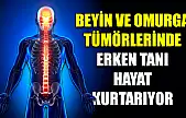 Beyin ve omurga tümörlerinde erken tanı hayat kurtarıyor