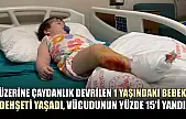 Üzerine çaydanlık devrilen 1 yaşındaki bebek dehşeti yaşadı, vücudunun yüzde 15'i yandı