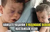 Vahşeti yaşayan 2 yaşındaki bebek hastanelik oldu