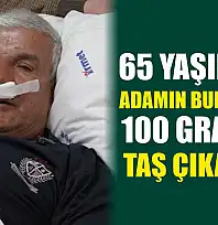 65 yaşındaki adamın burnundan 100 gramlık taş çıkarıldı