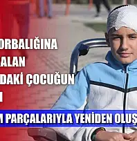 Akran zorbalığına maruz kalan 13 yaşındaki çocuğun kafatası titanyum parçalarıyla yeniden oluşturuldu