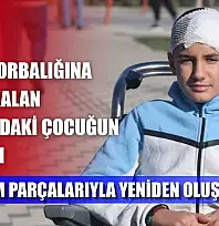 Akran zorbalığına maruz kalan 13 yaşındaki çocuğun kafatası titanyum parçalarıyla yeniden oluşturuldu