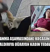Boşanma aşamasındaki kocasından bıçaklı saldırıya uğrayan kadın tedavi altında