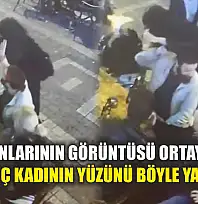 Dehşet anlarının görüntüsü ortaya çıktı... Genç kadının yüzünü böyle yaktı