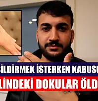 Dövme sildirmek isterken kabusu yaşadı, elindeki dokular öldü