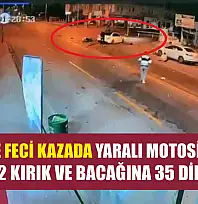 Fethiye'de feci kazada yaralı motosikletlinin kolunda 2 kırık ve bacağına 35 dikiş atıldı