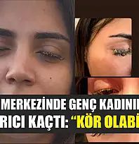 Güzellik merkezinde genç kadının gözüne yapıştırıcı kaçtı: 'Kör olabilirdim'