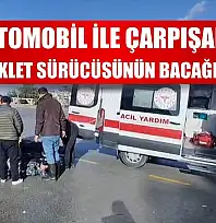 Otomobil ile çarpışan motosiklet sürücüsünün bacağı kırıldı