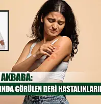 Prof. Dr. Akbaba: 'Kış aylarında görülen deri hastalıklarına dikkat'