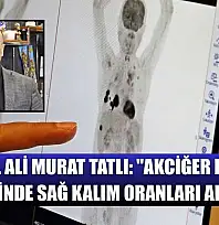 Prof. Dr. Ali Murat Tatlı: 'Akciğer kanseri tedavisinde sağ kalım oranları artıyor'