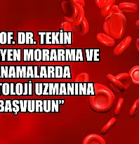 Prof. Dr. Tekin: 'Geçmeyen morarma ve kanamalarda hematoloji uzmanına başvurun'