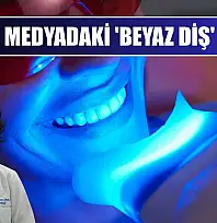Sosyal medyadaki 'beyaz diş' tuzağı