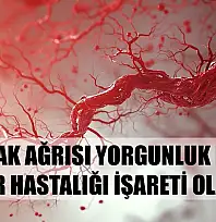 Uzmanı uyardı: 'Bacak ağrısı yorgunluk değil, damar hastalığı işareti olabilir'