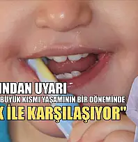 Uzmanından uyarı: 'Çocukların büyük kısmı yaşamının bir döneminde çürük ile karşılaşıyor'