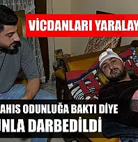 Vicdanları yaralayan olay: Otizmli şahıs odunluğa baktı diye odunla darbedildi