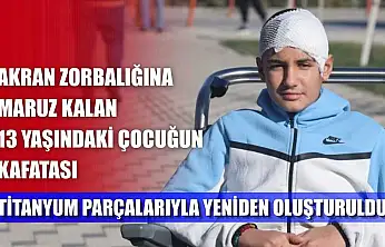 Akran zorbalığına maruz kalan 13 yaşındaki çocuğun kafatası titanyum parçalarıyla yeniden oluşturuldu
