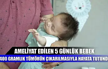 Ameliyat edilen 5 günlük bebek, 400 gramlık tümörün çıkarılmasıyla hayata tutundu