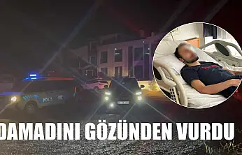Damadını gözünden vurdu