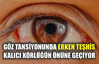 Göz tansiyonunda erken teşhis kalıcı körlüğün önüne geçiyor
