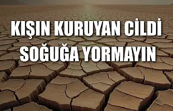Kışın kuruyan cildi soğuğa yormayın